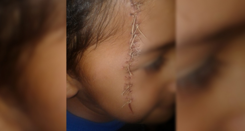 Maltrato infantil: denunció al padre y a la abuela por violencia física contra un menor de 5 años