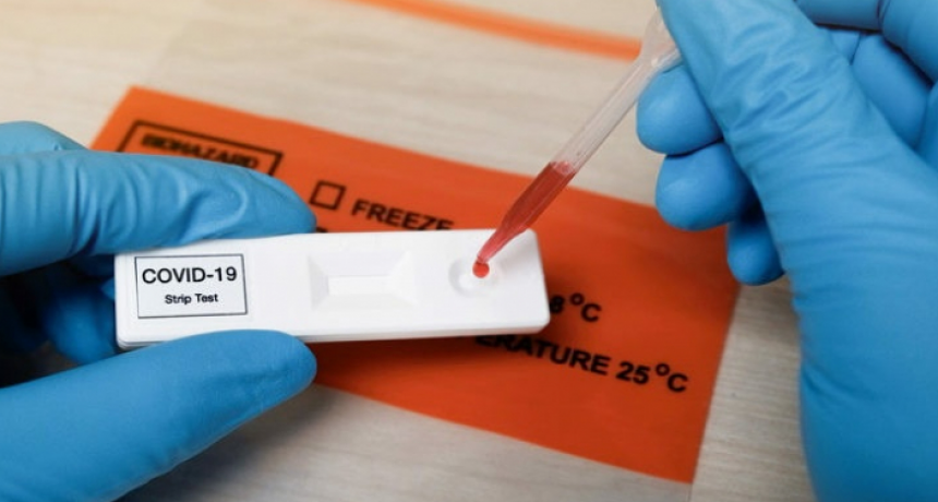 Confirmaron 466 nuevos contagios de COVID y 8 muertes en las últimas 24 horas