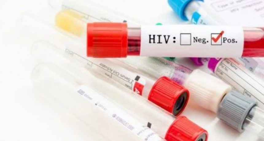 Descubren una variante del VIH más virulenta y contagiosa
