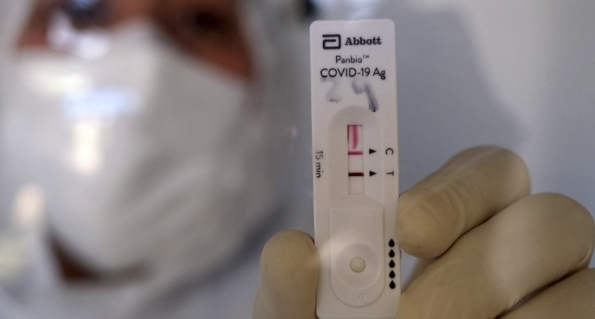 Llegaron al pa&iacute;s 2,2 millones de test para la detecci&oacute;n r&aacute;pida de coronavirus