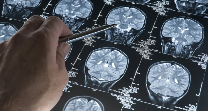 El laboratorio que produce la nueva droga contra el Alzheimer empezar&aacute; a distribuirla en dos semanas