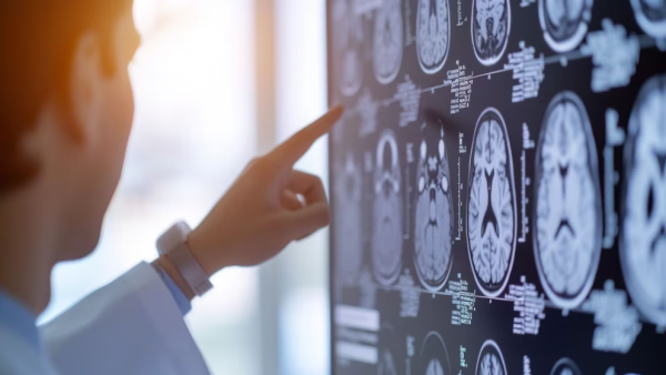 Qu&eacute; hacer ante un ACV: pasos inmediatos y errores que se deben evitar