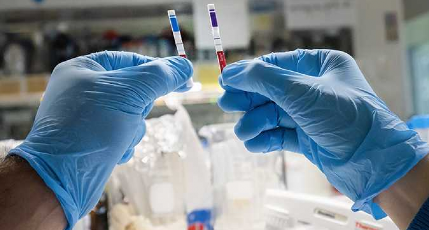 Hacia el primer test de ant&iacute;genos 100 % argentino