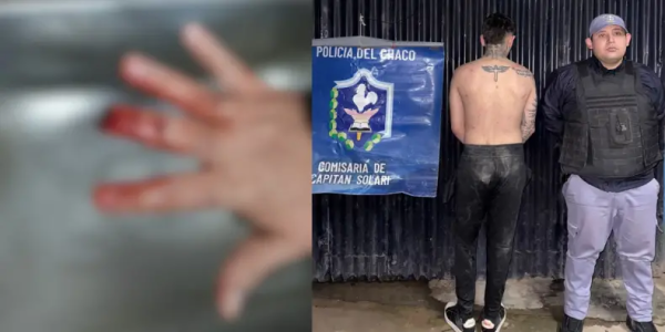En una crisis, joven con problemas de consumo atac&oacute; a su familia y le arranc&oacute; parte de un dedo a un polic&iacute;a